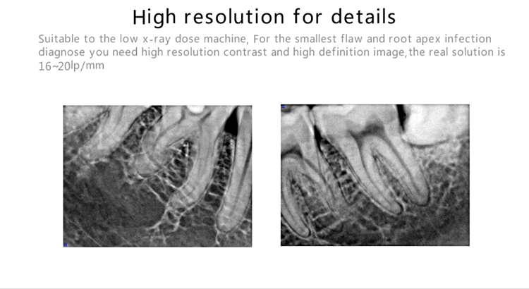 XR45 Intraoral Sensor HDR-500